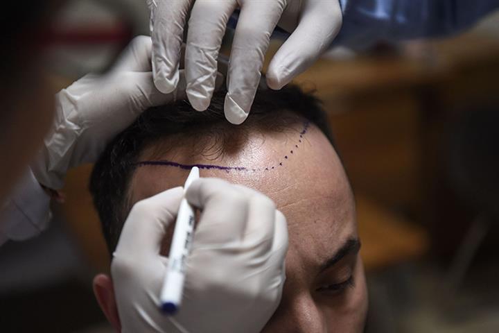 Chinese Hair Transplant Clinic Yonghe Aims to Raise USD191 Million in Hong Kong IPO Chinese Hair Transplant Clinic Yonghe Aims to Raise USD191 Million in Hong Kong IPO