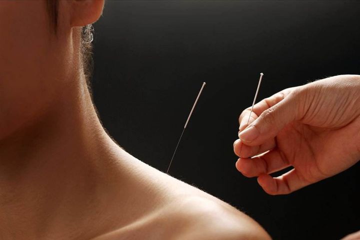 Attorneys General of US States Urge Insurers to Add Acupuncture for Pain Treatment