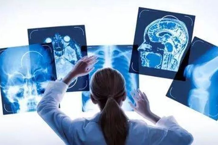 AI Medical Imaging Firm Huiyihuiying Completes Series B Financing Round