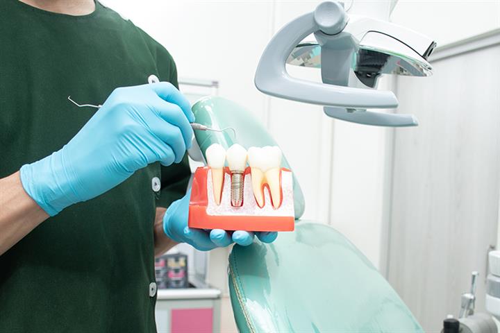 Dental Implant Prices Drop 55% After China Adds Them to Bulk-Buying Program