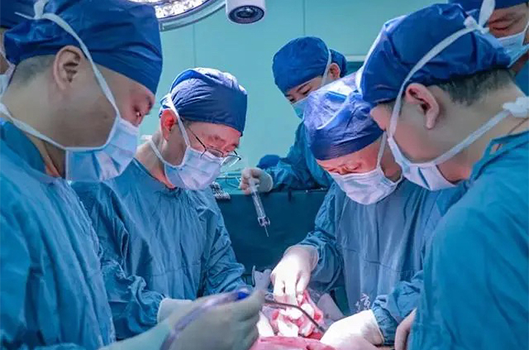 Chinese Team Conducts World’s First Xenogeneic Liver Transplant Into Brain-Dead Patient