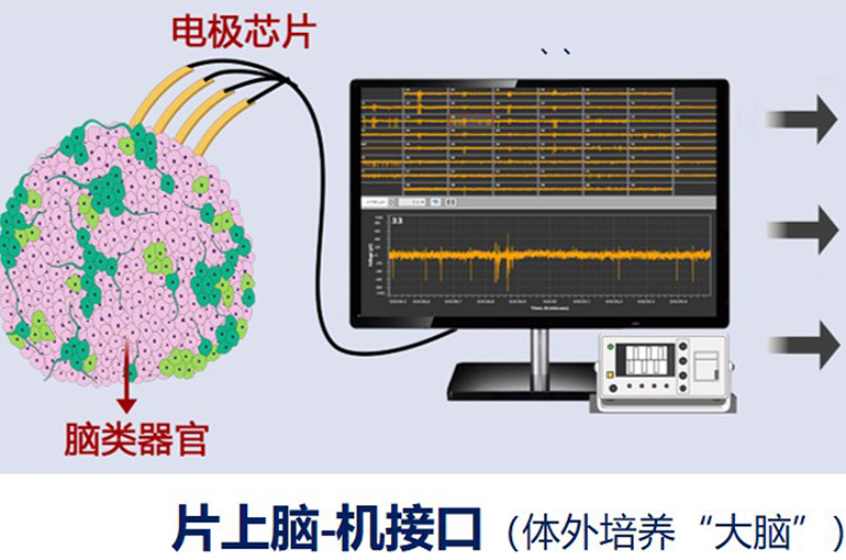 Chinese Scientists Develop World’s First Open-Source Brain-on-Chip Interface System