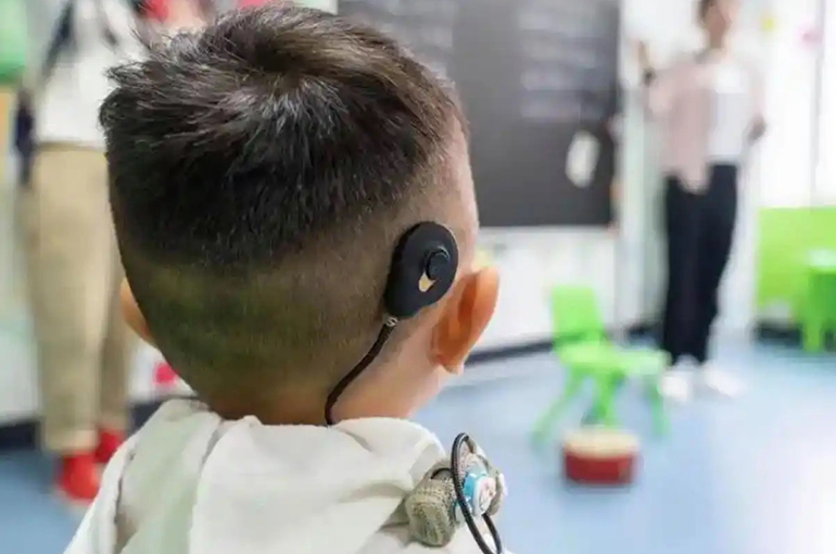 Gene Therapy Outperforms Cochlear Implants for Congenital Deafness, Chinese Study Shows