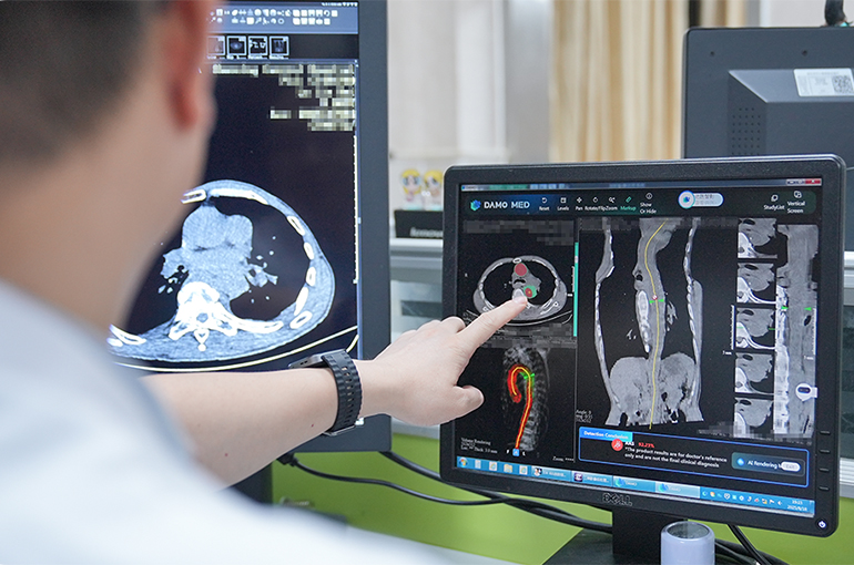 Alibaba, Tencent’s Medical AI Models Break Into Critical Care