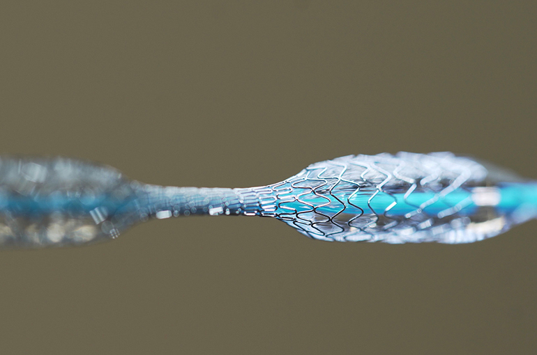 China’s Coronary Stent Bulk Buying Has Cut Costs Without Harming Clinical Outcomes, Report Shows